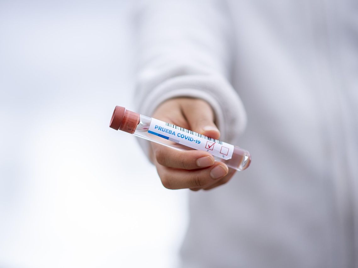 Gdzie zrobić test PCR we Wrocławiu jakie są opcje i na co zwrócić uwagę?