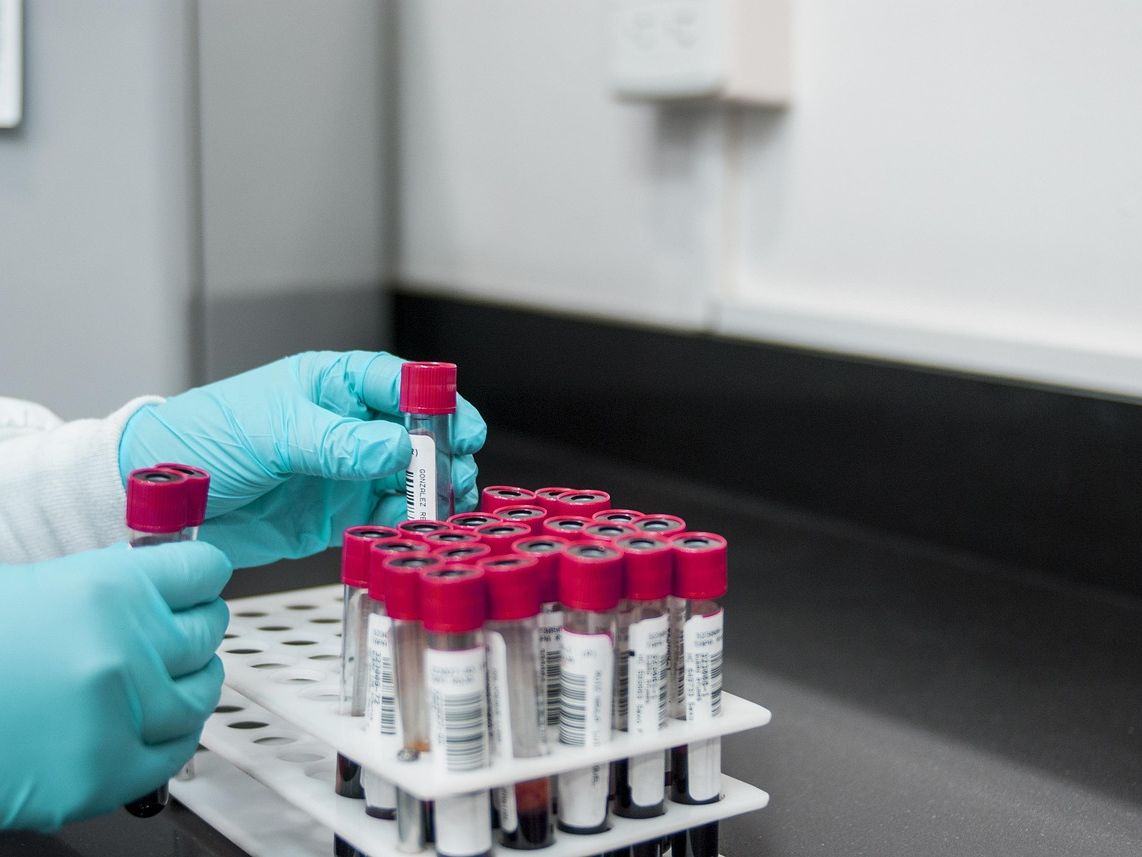 Kiedy warto wykonać test PCR na obecność patogenu?